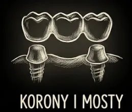 Korony i mosty