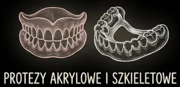 Protezy akrylowe i szkieletowe